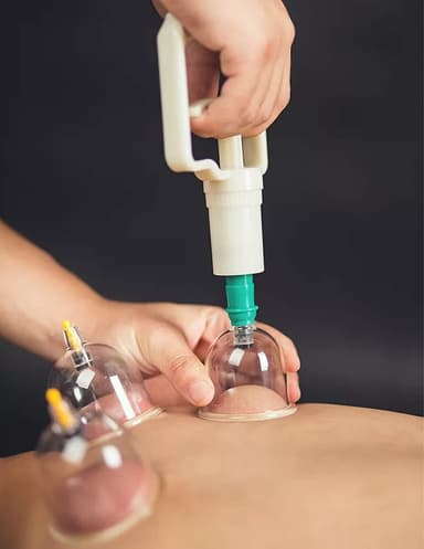 Cupping med vakuumpumpe til behandling og massage 12 stk