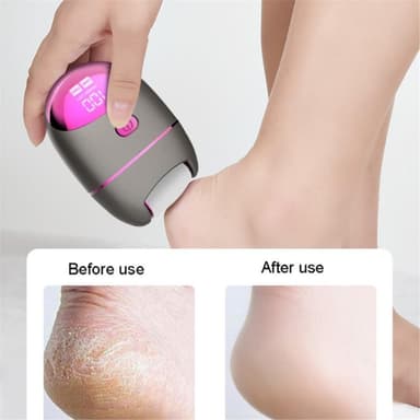 Elektrisk fodsliber Calluses Fjernelse Pedicureplejemaskine